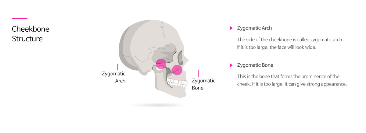 광대뼈의 구조 - 관골궁(arch), 옆 광대 부분을 말합니다. 이 부위가 발달한 경우 얼굴 폭이 넓어 보입니다., 관골체부(body), 광대뼈의 본체 부위입니다. 이 부분이 발달한 경우 인상이 강해집니다.